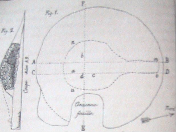 Plan_tumulus_A.jpg