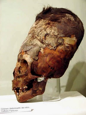 skull-paracas.jpg