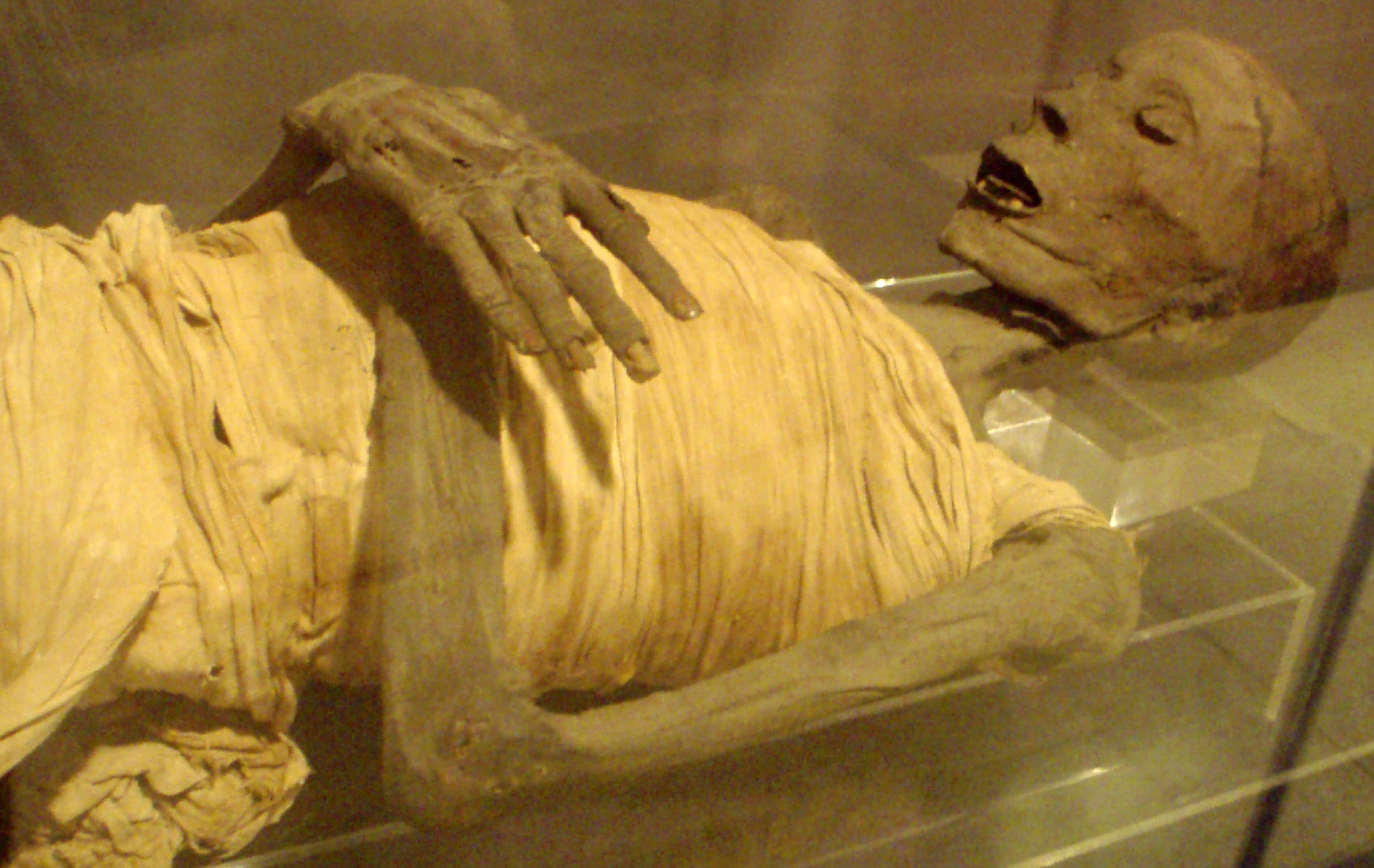 Mummy-UpperClassEgyptianMale-SaitePeriod_RosicrucianMuseum.png