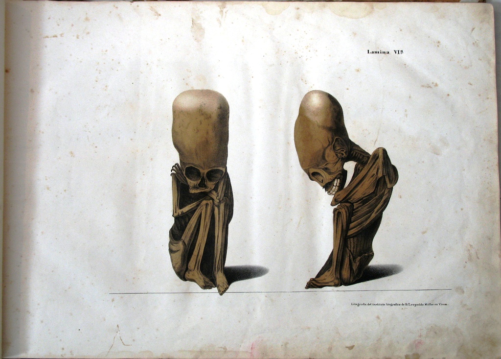 fetus.jpg